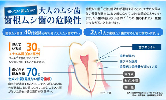 歯の予防は根元から「歯根ムシ歯」にご用心