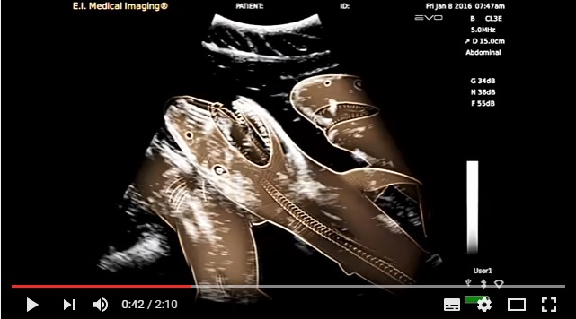 ビックリ動画 妊娠中のイタチザメのお腹を超音波エコーで見てみたら 赤ちゃんザメが匹も Pouch ポーチ