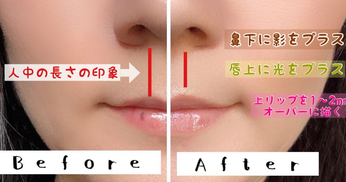 検証 整形級の効果アリ 鼻の下を短く見せる 人中短縮スティック を使ってみた結果 Pouch ポーチ